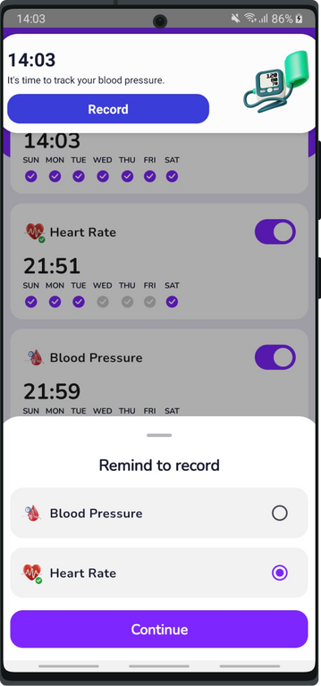 Screenshot of the Reminder feature on Health Tracker App, displaying customizable reminders for medication, appointments, and health-related tasks to help users stay organized and on track with their health goals.